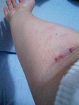090227injected.jpg